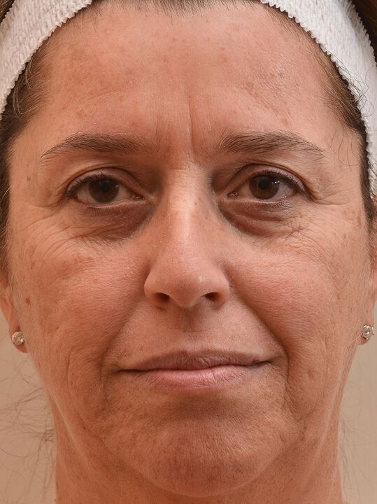 Also ech hunn gekuckt ier ech eudalie Creme benotzen