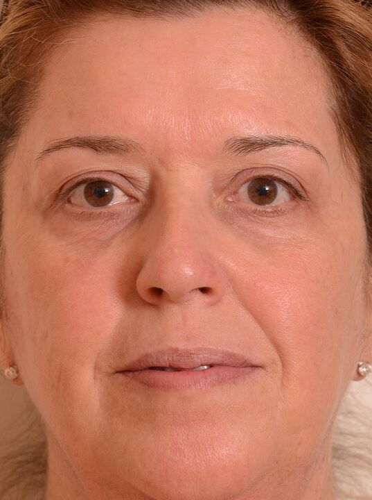 Ech hunn mäi Gesiicht mat Eudalie Crème verjéngert