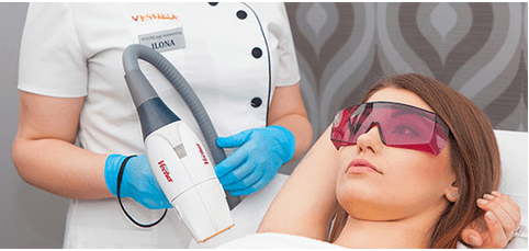 Laser Rejuvenatioun