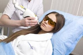 Feld Laser Rejuvenation