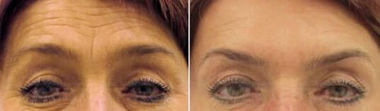 Feldverjuvenatioun vum Stiermer