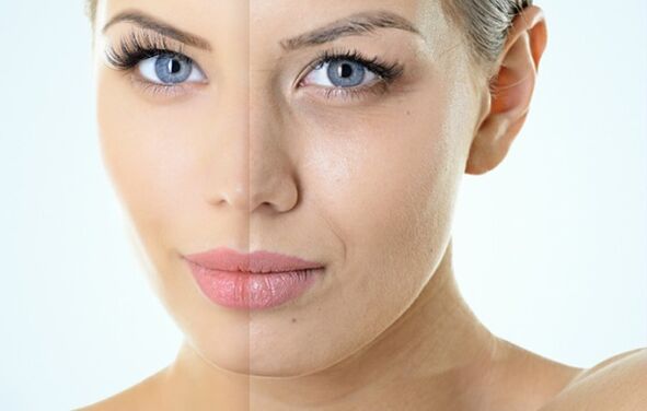 Indikatiounen fir Fraktioun Rejuvenatioun